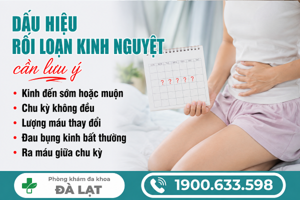 Hình ảnh minh họa